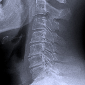 Radiografía de columna en Barcelona  AMEDICS Centre Mèdic  al precio de 15€