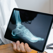 Radiografía de Extremidades Superiores o Inferiores