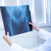 Radiografía de pelvis (1 proyección)